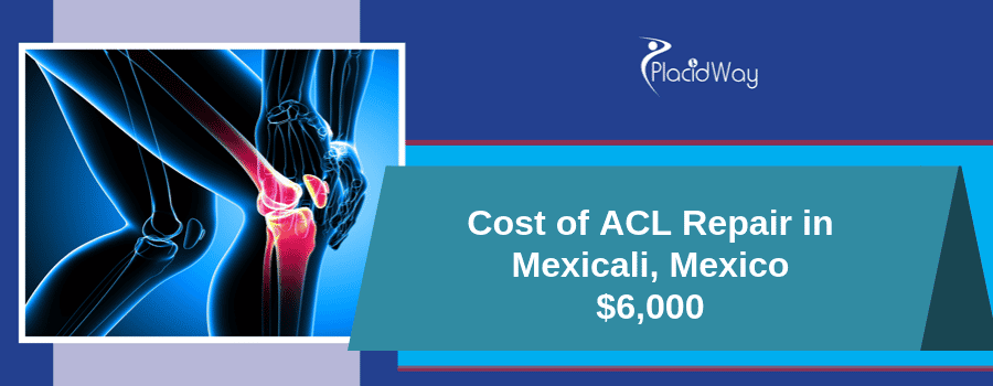 Cost of ACL Repair in Mexico